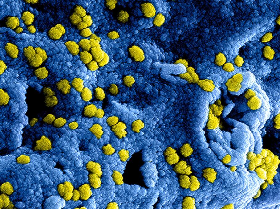 Alibaba Cloud opens virus detection service to the world for free