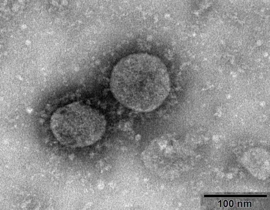 Does 'mutation' mean coronavirus more likely to infect people?