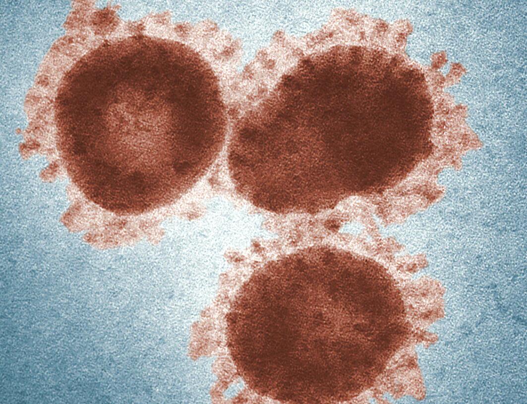 What is the difference between Covid-19 and inflammatory bowel disease?