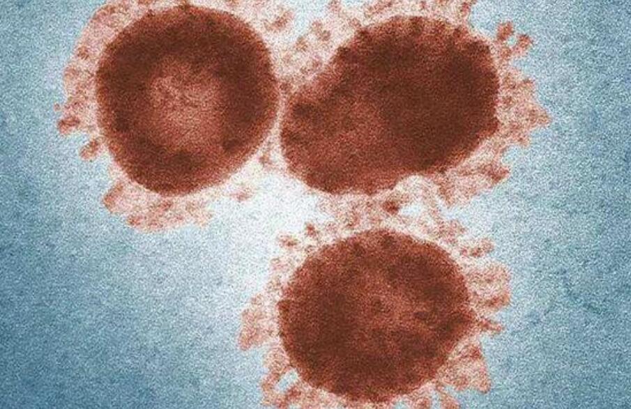Attention should be paid to coronavirus liver injury, paper says