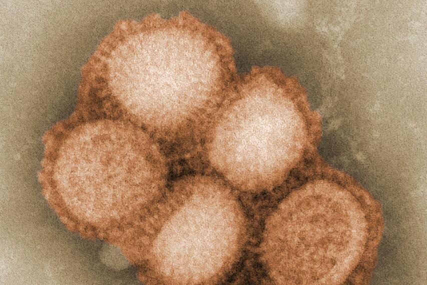 Experts doubt study that says blood type A more prone to coronavirus
