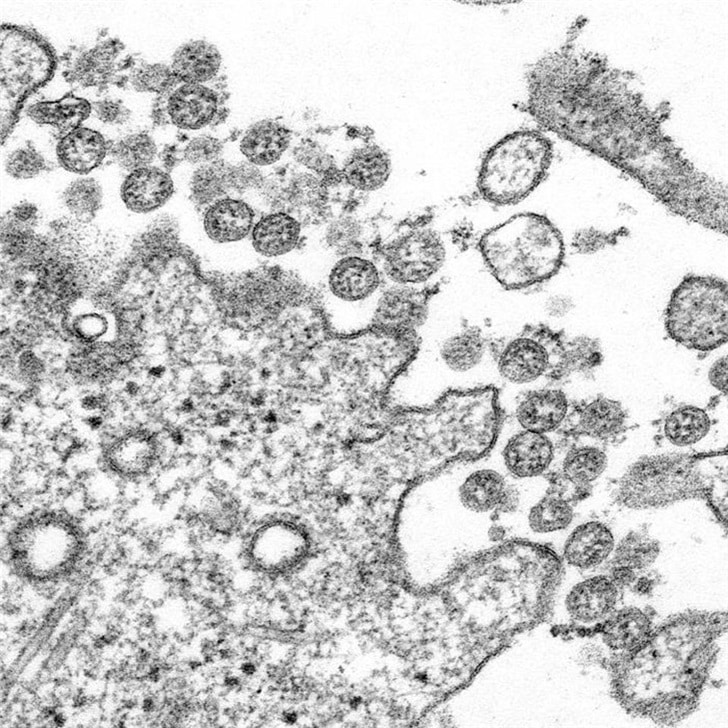 US CDC releases unmodified images of new coronavirus-CnTechPost