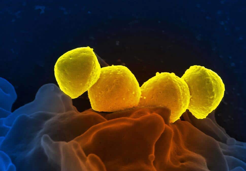 Coronavirus can survive in 92°C water, new study finds