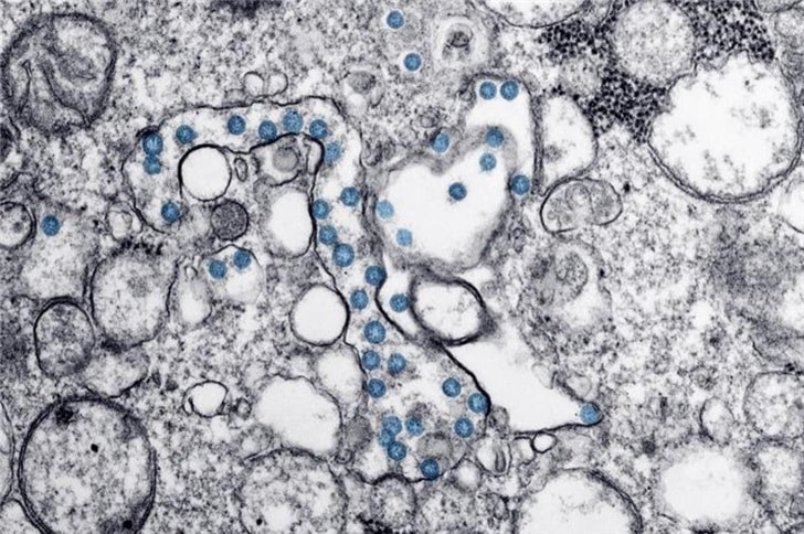 US CDC releases unmodified images of new coronavirus-CnTechPost