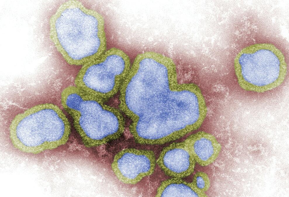 Nasal cavity and lungs are weaknesses that coronavirus attack, study says