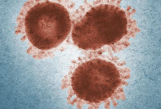 Rare complication of new coronavirus pneumonia can paralyze patients