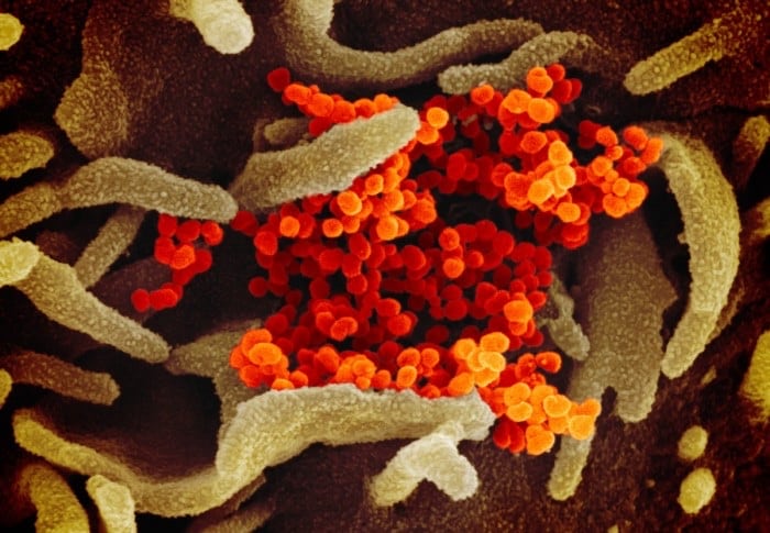 Study shows effective antibodies in patients recovering from Covid-19