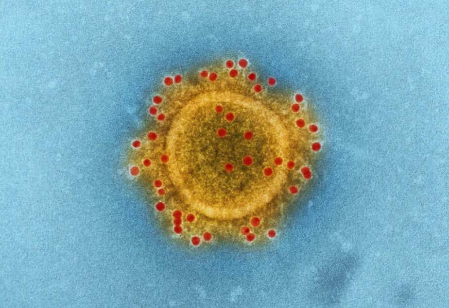 Coronavirus can cause deadly blood clots in the lungs, study finds