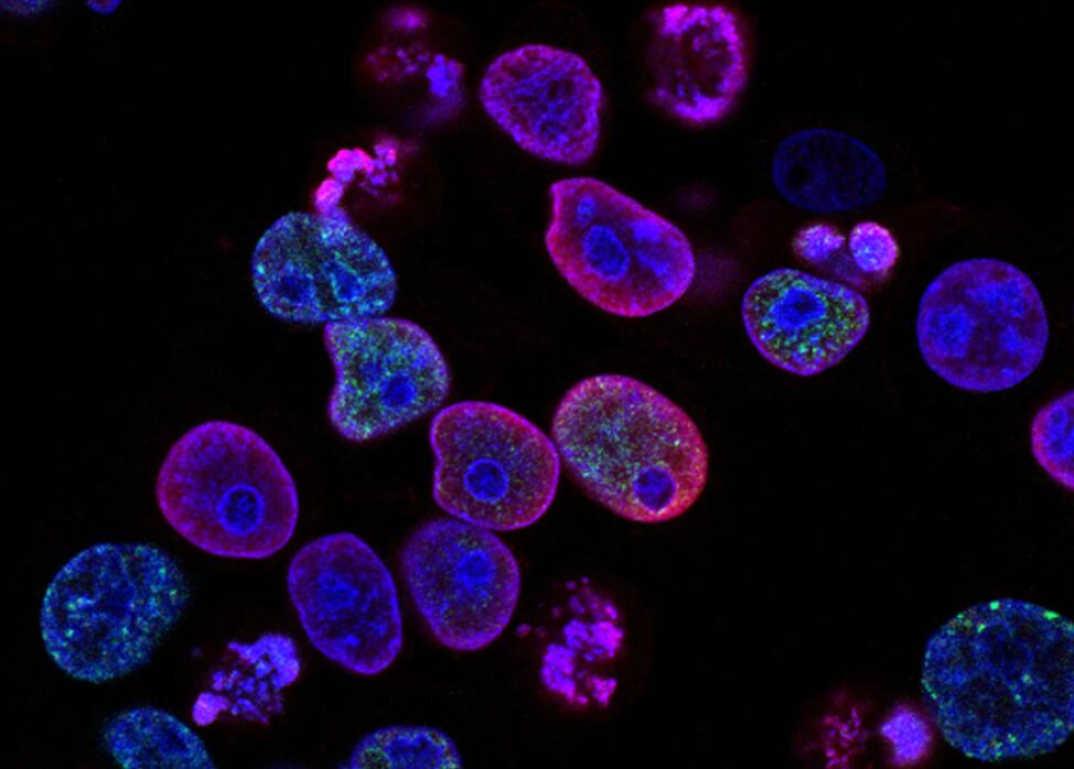 Besides Covid-19, watch out for these three diseases
