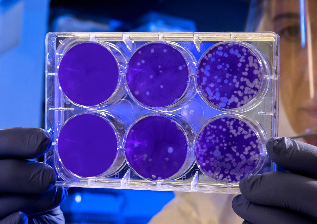 How to distinguish between common cold and new coronavirus infection