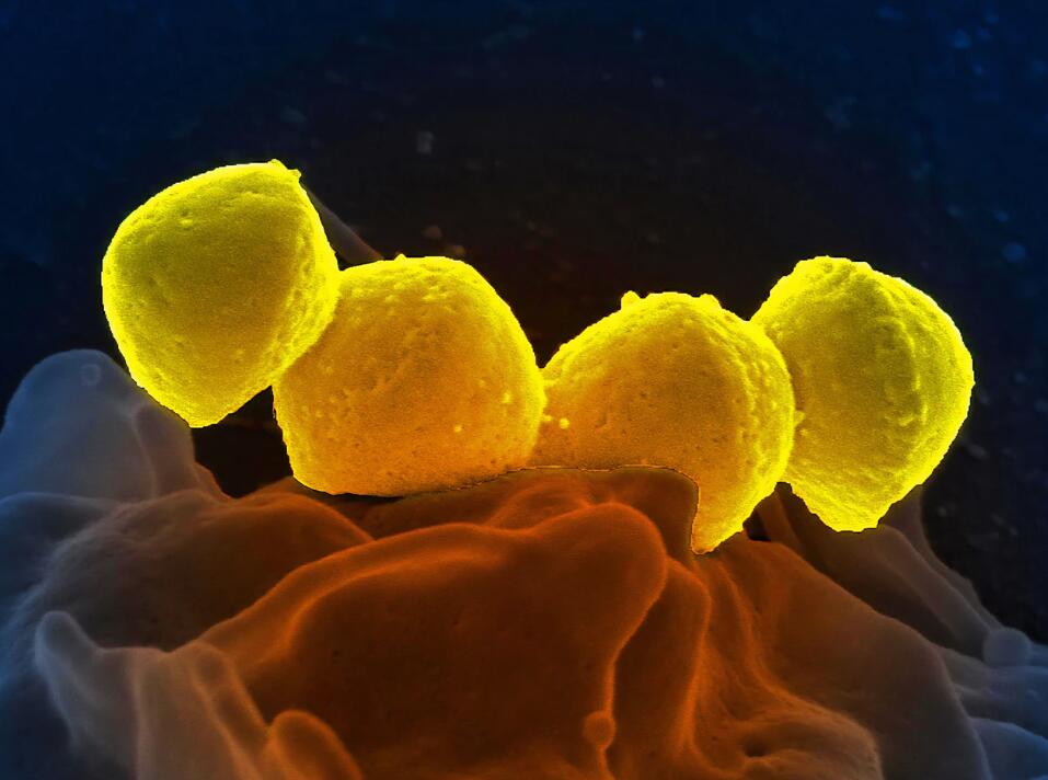 A Chinese university lab says it has developed oral vaccine for coronavirus-CnTechPost