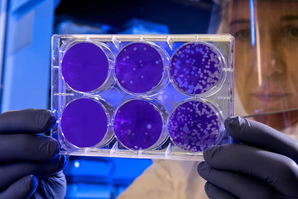 Global scientific institutions search for drugs to fight coronavirus