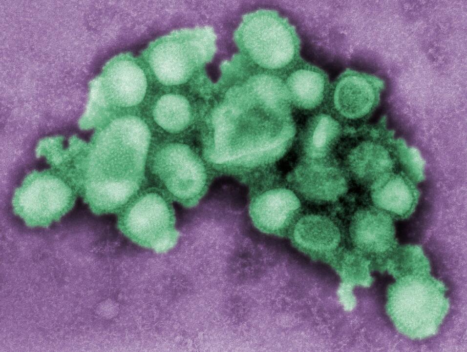 WHO says new coronavirus pneumonia and seasonal flu have 4 main differences