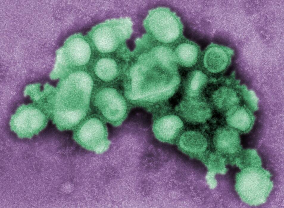 Covid-19 may evolve to flu-like with early symptoms more subtle, research finds
